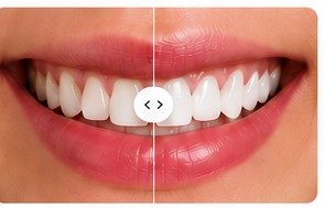Caso de estética dental